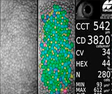 Microscopia especular de Córnea
